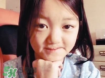 兔唇是什么？兔唇是什么原因造成的？