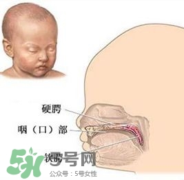 兔唇能檢查出來嗎？兔唇能完全修復(fù)嗎？