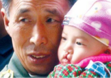 兔唇是什么？兔唇是什么原因造成的？