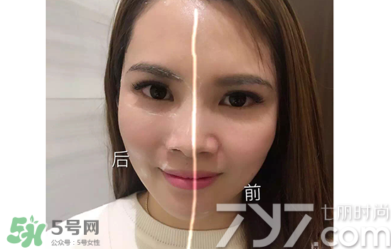 黃金棒有什么用？黃金棒的功效與作用