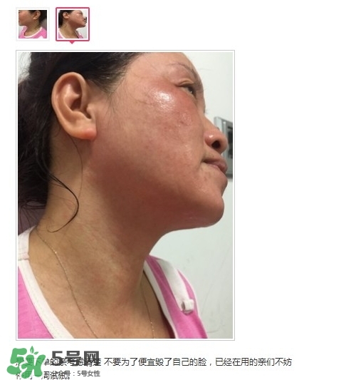 肌膚之食是什么牌子？肌膚之食讓我毀容了