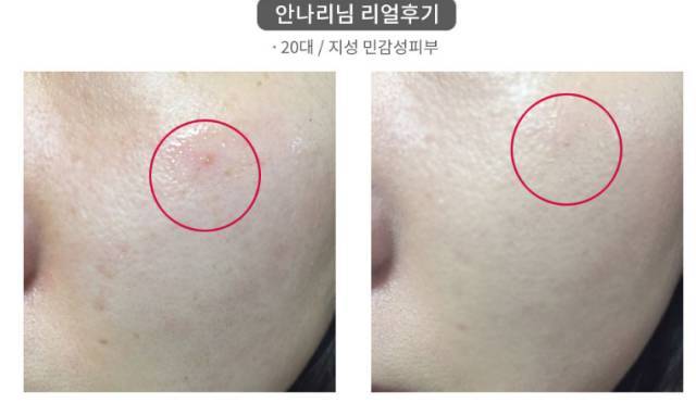 real skin patch怎么樣？real skin是什么牌子