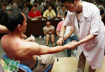 刮痧痛嗎？刮痧疼還是拔罐疼