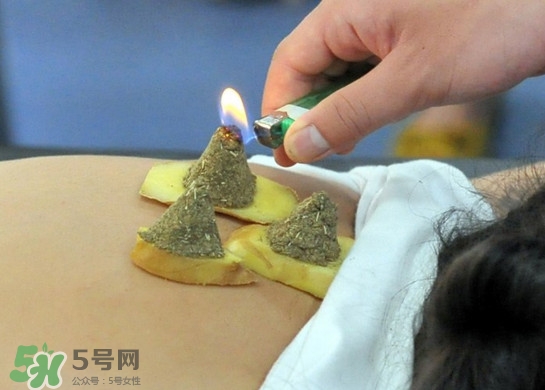 三伏灸有用嗎？2017年三伏艾灸時(shí)間