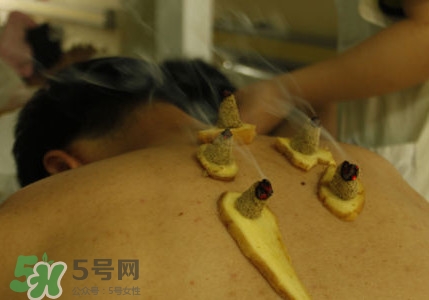 三伏灸有用嗎？2017年三伏艾灸時(shí)間