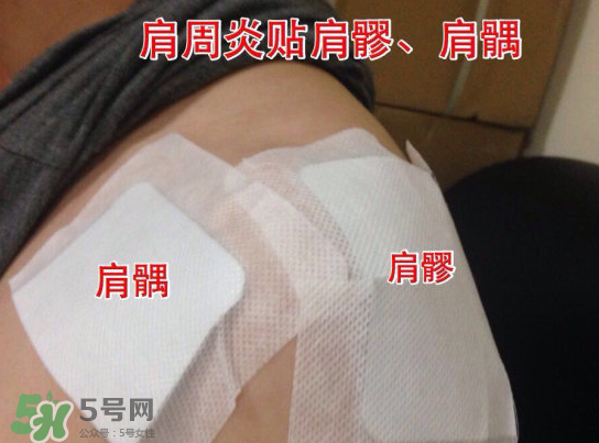 艾灸貼多少錢一盒?？艾灸貼一盒60裝多少錢？