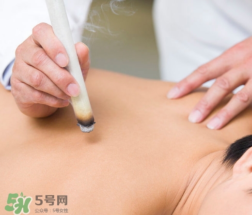 三伏貼和艾灸哪個(gè)好？三伏貼和艾灸區(qū)別