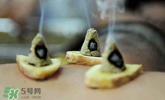 貼三伏貼可以艾灸嗎？貼三伏貼多久可以艾灸