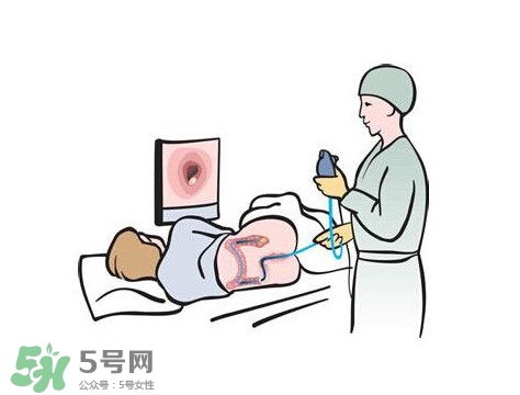 直腸癌怎么查出來的？直腸癌怎么判斷早晚期