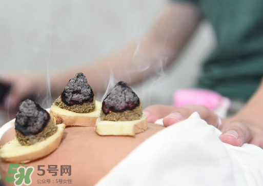三伏灸什么人不能做？三伏灸適合哪些人？
