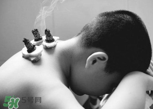 三伏灸什么人不能做？三伏灸適合哪些人？