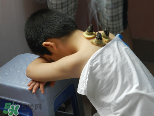 三伏灸什么時(shí)候做最好？?三伏灸可以晚上做嗎？