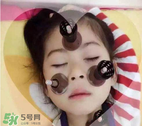 艾灸貼可以治咳嗽嗎？艾灸貼可以治退燒嗎？