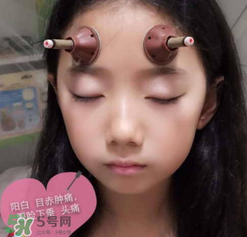 艾灸貼可以治咳嗽嗎？艾灸貼可以治退燒嗎？