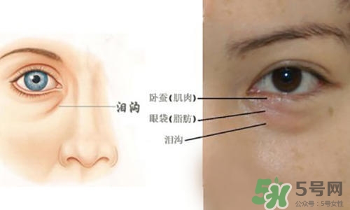 淚溝能自己恢復(fù)嗎？淚溝怎么自己恢復(fù)？