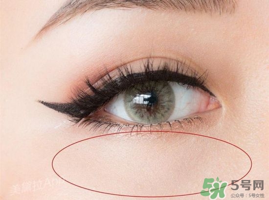 玻尿酸填充淚溝多久恢復(fù)自然？玻尿酸填充淚溝的危害