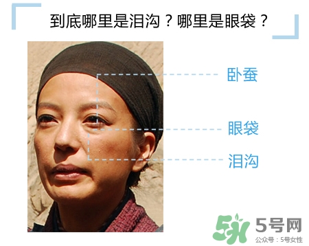 玻尿酸填充淚溝多久恢復(fù)自然？玻尿酸填充淚溝的危害