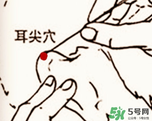 什么人不能做放血療法？放血療法有什么功效？