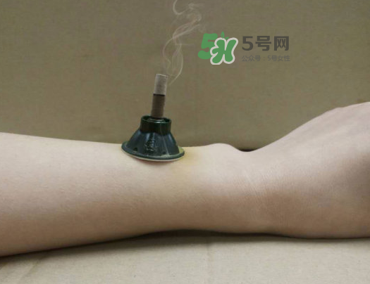 三伏天下雨可以艾灸嗎？三伏天下雨艾灸好嗎？