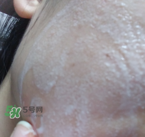 貝蜜清凈痘控油潔面啫喱怎么樣？貝蜜清祛痘控油潔面啫喱好用嗎？