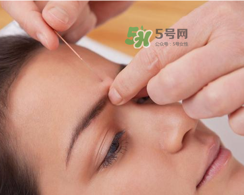 三伏天針灸有什么好處？三伏天針灸注意什么？