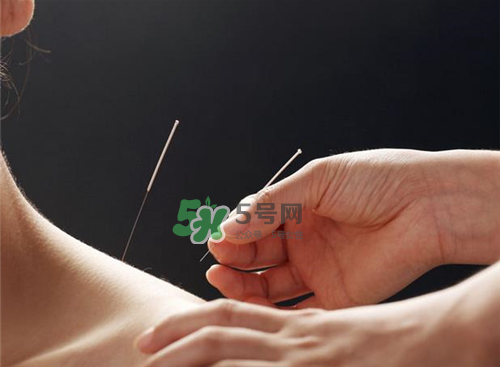 三伏天針灸有什么好處？三伏天針灸注意什么？