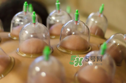 拔火罐是夏天好還是冬天好？什么時候拔火罐最合適？