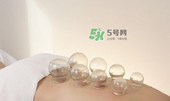 拔火罐是夏天好還是冬天好？什么時候拔火罐最合適？