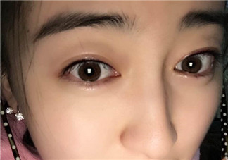 做美瞳線會不會掉睫毛？做美瞳線掉睫毛怎么辦？