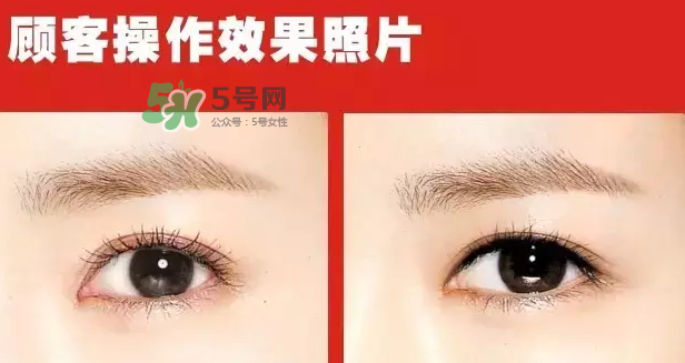 美瞳線有必要做嗎？做美瞳線多少錢？