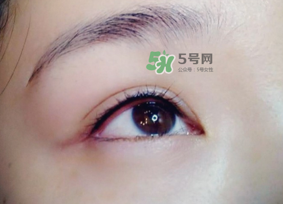 做美瞳線疼嗎？做美瞳線后要注意什么？