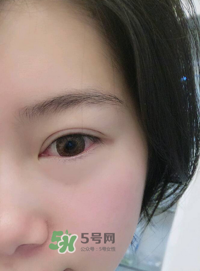 做美瞳線疼嗎？做美瞳線后要注意什么？