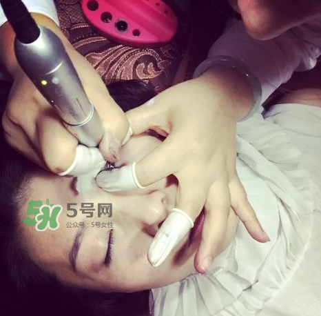 做美瞳線(xiàn)要打麻藥嗎？做美瞳線(xiàn)麻藥怎么敷？