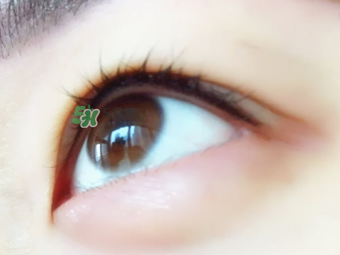 做美瞳線麻藥進眼睛怎么辦？做美瞳線麻藥灼傷眼睛怎么辦？