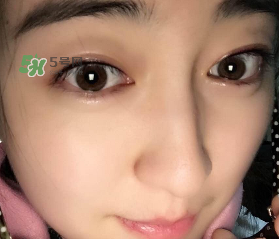 做美瞳線可以喝酒嗎？做美瞳線喝酒有影響嗎？