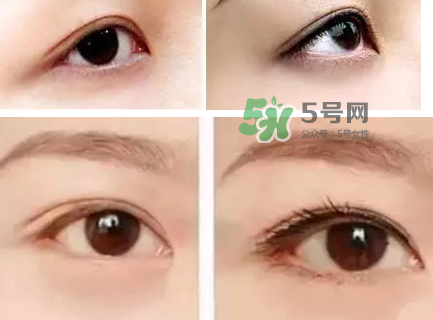 做美瞳線可以吃雞蛋嗎？做美瞳線能吃雞蛋嗎？