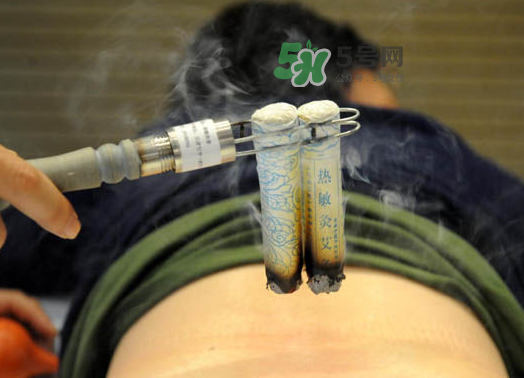 三伏天艾灸后能吹空調(diào)嗎？三伏天艾灸后能吹電扇嗎？