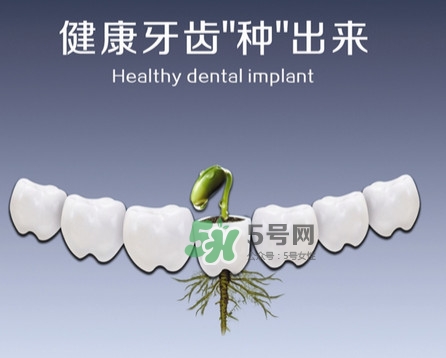種植牙費用多少錢？國產(chǎn)種植牙價格