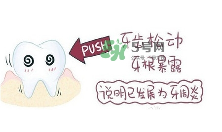 牙齒松動(dòng)會(huì)自己好嗎？牙齒松動(dòng)會(huì)自己掉嗎