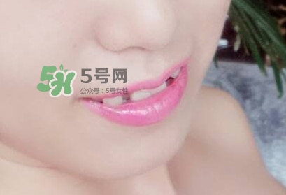 牙齒縫隙大怎么辦？牙縫大帶牙套有用嗎