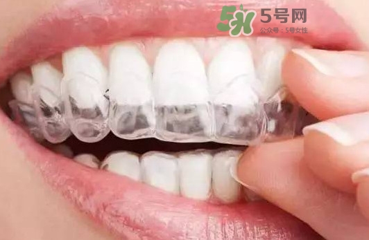 牙齒有縫隙可以補(bǔ)嗎？牙齒縫隙大能補(bǔ)嗎