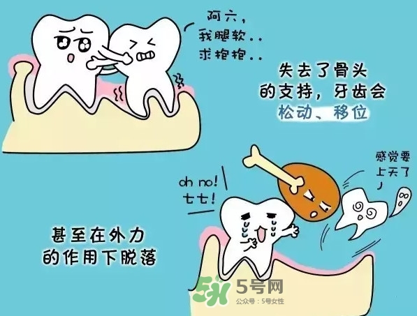 牙齒松動(dòng)會(huì)自己好嗎？牙齒松動(dòng)會(huì)自己掉嗎