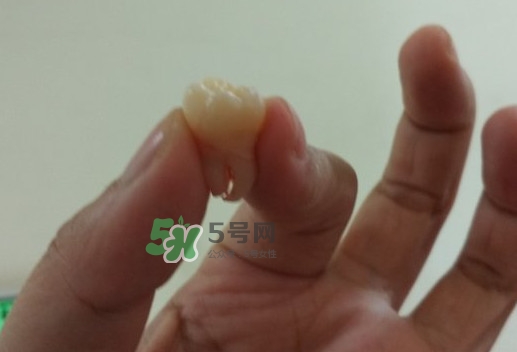 拔智齒痛嗎？智齒拔了多久洞會好？