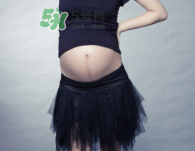 頭胎有妊娠線二胎沒有是因為寶寶性別不一樣嗎？