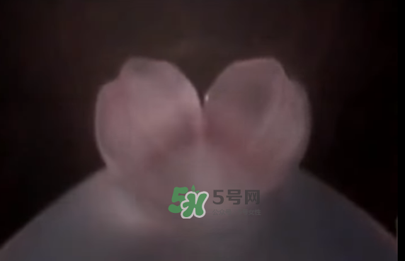 懷孕初期怎么保胎？陰道出血是流產(chǎn)征兆嗎？