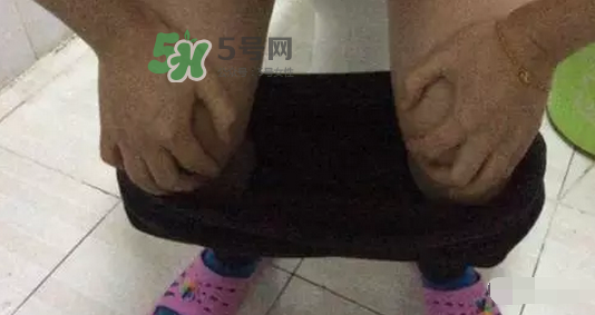 孕期可以蹲著上廁所嗎？孕期上廁所會(huì)壓到寶寶嗎？