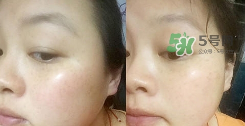可思美潔面儀好不好用？可思美凈致潔顏聲波潔面儀怎么樣？