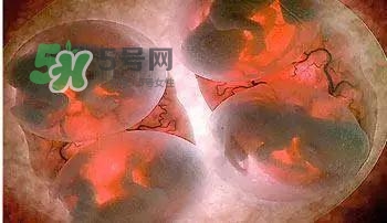 多胞胎是怎么生產(chǎn)的？多胞胎應(yīng)選擇什么分娩方式