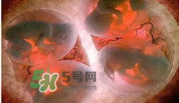 多胞胎順產怎么生？多胞胎剖腹產和單胎剖腹產的區(qū)別