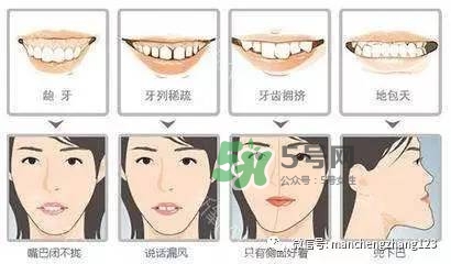 乳牙齲齒要不要補？乳牙齲齒怎么辦？